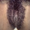 Bushy Jamaican Genitals Close-Up