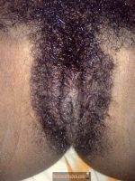Bushy Jamaican Genitals Close-Up